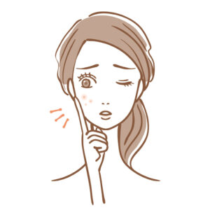 大人ニキビ、漢方で対策